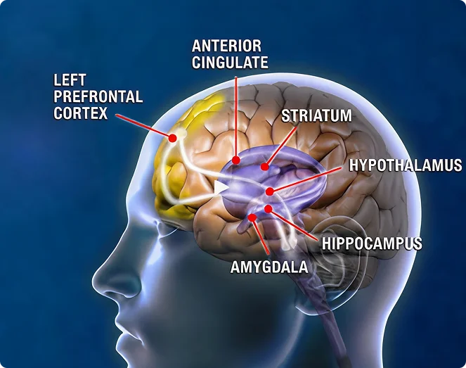 neurostar2